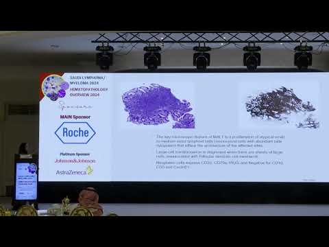 06 Gastrointestinal lymphomas | Dr. Leena Taher | 26 Oct 2024