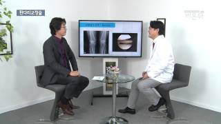 [기획취재] 관절염, 휜다리 교정술로 치료한다!