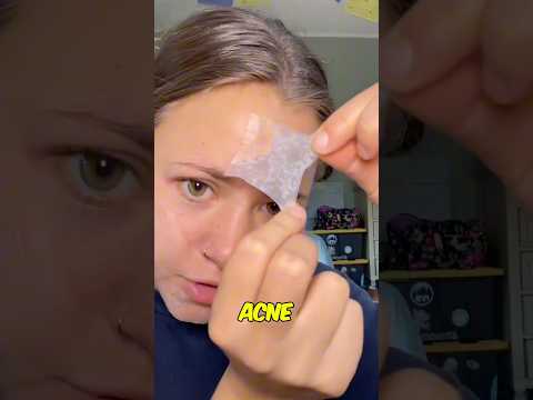 This is The Best Acne Product? 😳😨