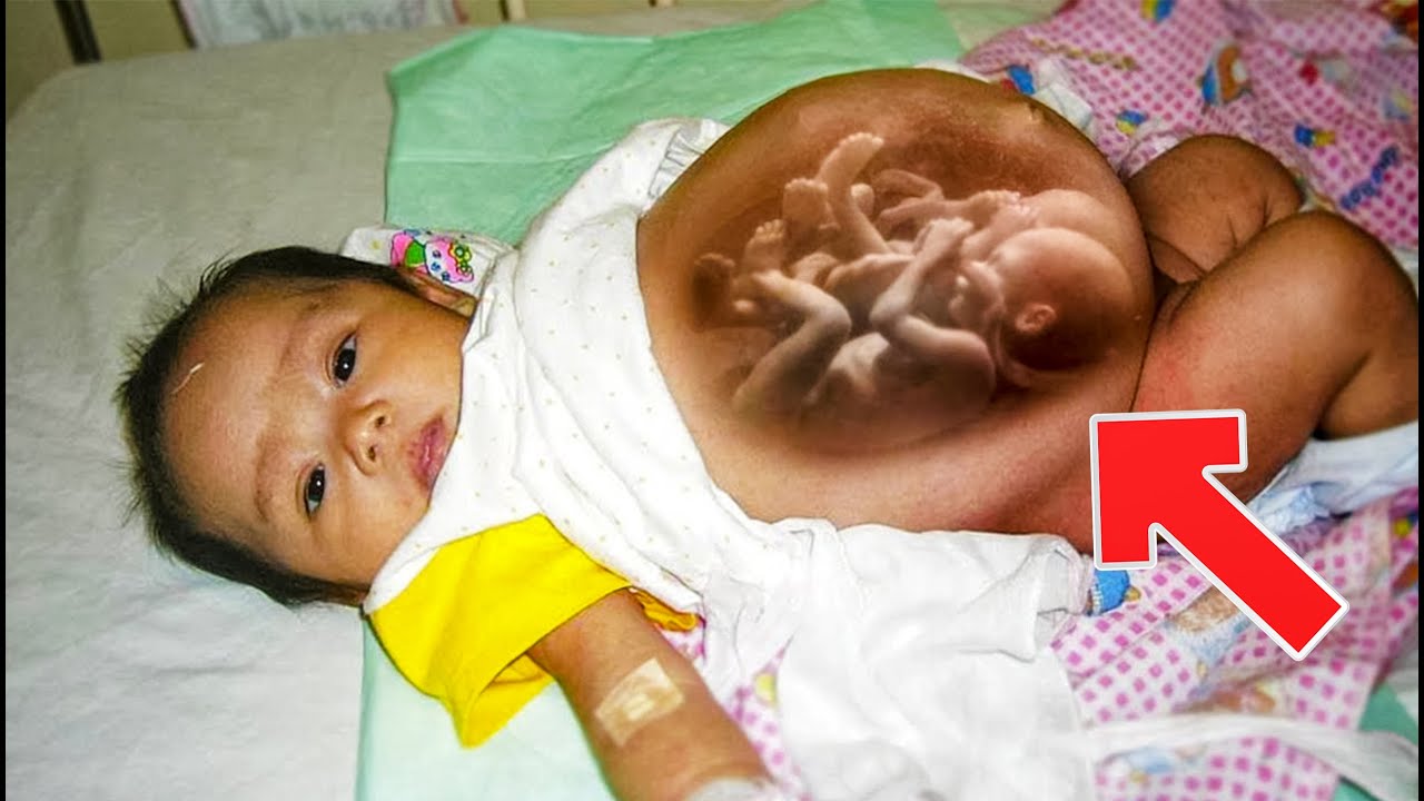 Can a baby be born pregnant? Life Set Go