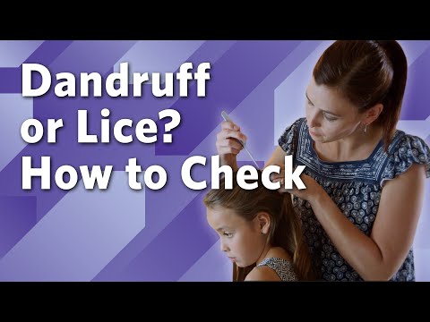 How to Check for Lice