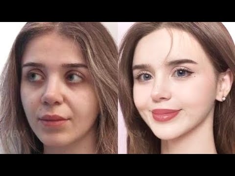 ⚠︎  EXTREME FACE LIFT 💉 ˖ ࣪ EXPERIMENTAL ANTI-AGING PROCEDURES