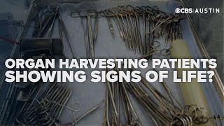 'Unethical': HHS report reveals organ harvesting while patients still show signs of life