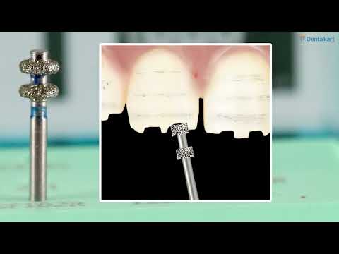 Waldent Crown & Bridge Tooth Preparation Diamond Bur Kit Set of 14