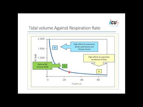 Adaptive Support Ventilation (ASV):  A Closed Loop Ventilation with Pressure-Targeted Mode