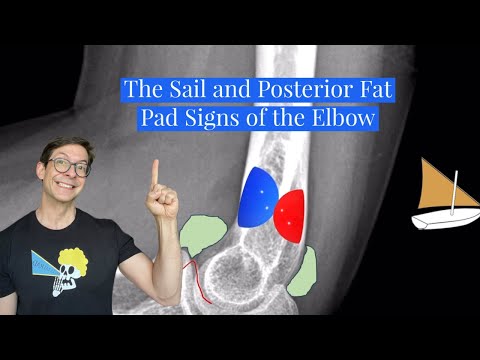 Sail and Posterior Fat Pad Signs of the Elbow Joint