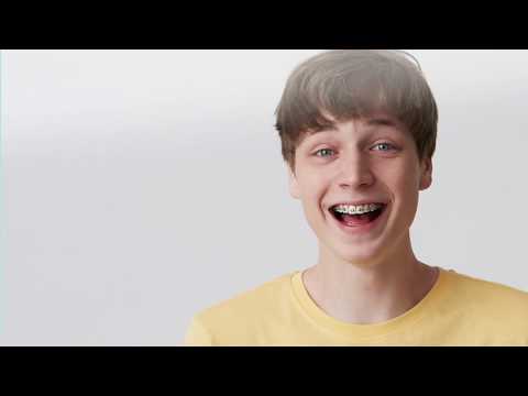 TePe Share Webinar - Cura degli apparecchi ortodontici