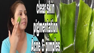 Get clear skin,remove pigmentation,acne pimple and scars with fresh ALOE VERA GEL | kaurtips |
