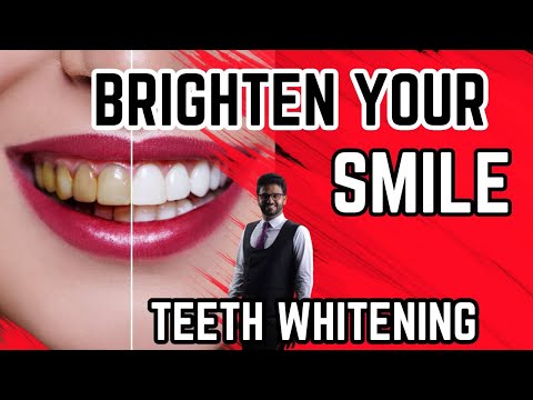 download lagu mp3 mp4 Teeth Whitening Dentist Cost In Chennai, download lagu Teeth Whitening Dentist Cost In Chennai gratis, unduh video klip Teeth Whitening Dentist Cost In Chennai