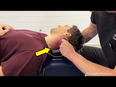 Hurt By Previous Chiropractor 😞 Helping A *FROZEN NECK* Break FREE The Right Way - CRUNCH!