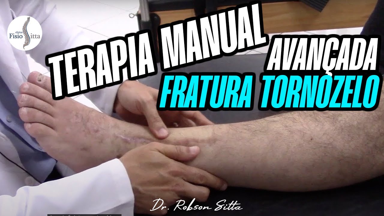 TERAPIA MANUAL TORNOZELO - FRATURA DO PILÃO TIBIAL Clínica de Fisioterapia Dr. Robson Sitta