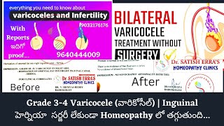వారికోసీల్ గ్రేడ్ 3-4లో ఉన్నా సర్జరీ లేకుండా తగ్గుతుంది| Varicocele Grade 3-4 No Surgery | Dr.Satish Erra's Homeopath Clinics