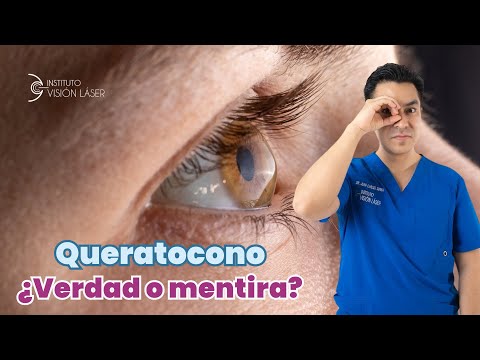 ¿Queratocono: verdad o mentira 🫥?