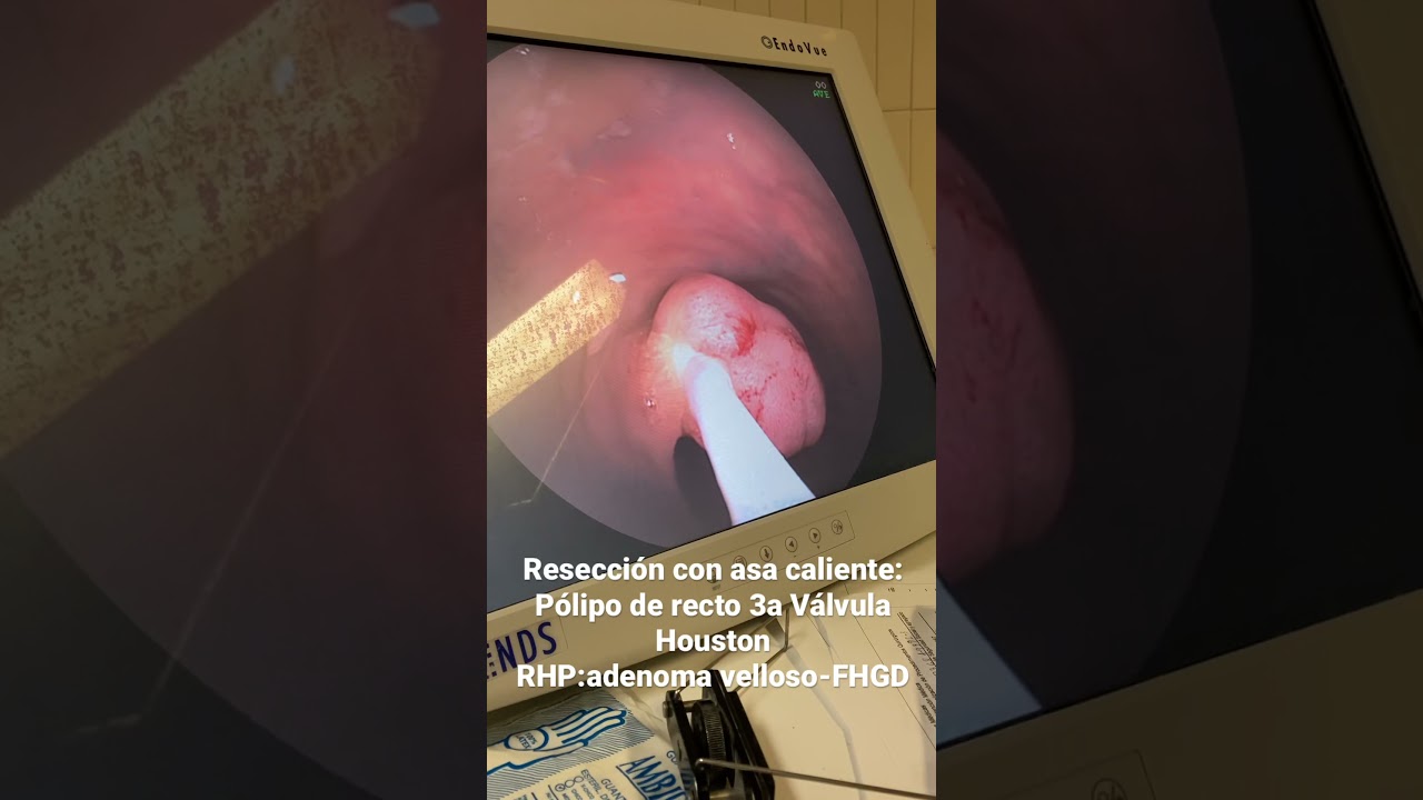 J. César Reyes Vásquez-33