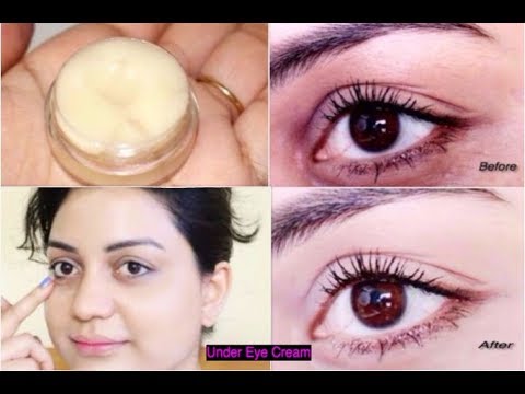 EYE CREAM To Remove Intense Dark Circles, Fine lines,...