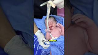 Download lagu Cute Newborn Baby Girl #short #viral #cutebaby #newborn #baby #bornbaby #babies #shortsfeed mp3 Download lagu Cute Newborn Baby Girl #short #viral #cutebaby #newborn #baby #bornbaby #babies #shortsfeed mp3