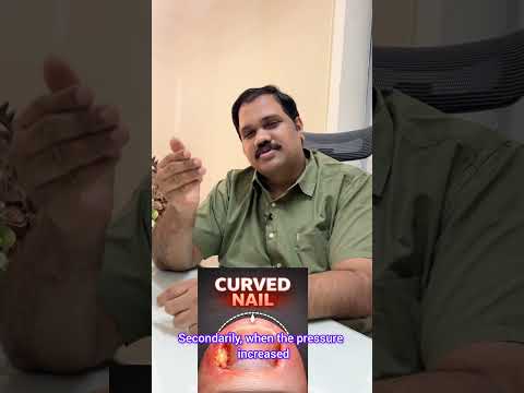Ingrown toenail treatment short video thumbnail by Dr. Ram Prabhu.