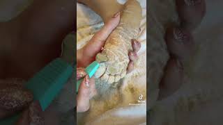 Full foot callus removal - Epidermolytic Palmoplantar Keratoderma - Jan 30, 2023