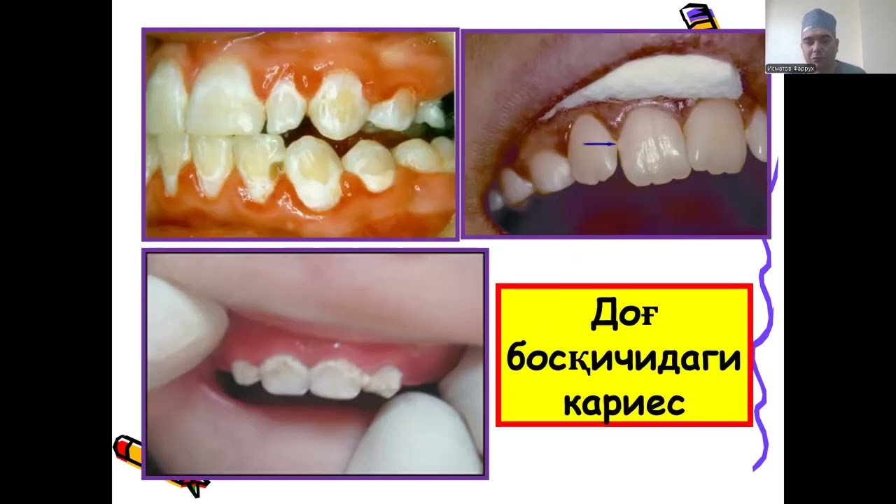 Stomatologiya fani va vazifalari. Asosiy muammolari