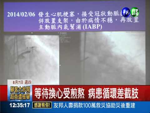 亞洲第一! 台大完成500例心臟移植