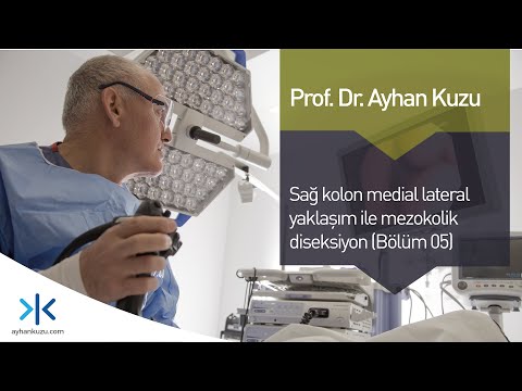 Sağ Kolon Medikal Lateral Yaklaşım İle Mezokolik Disseksiyon Planları