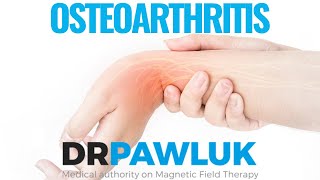 FAQ - What dosage do you use for Osteoarthritis?