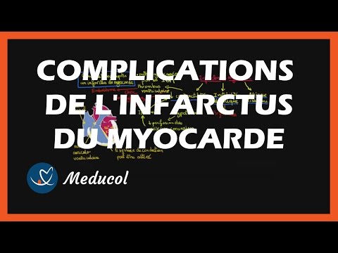 Lhypertension que remplacer La pression artérielle 70-160