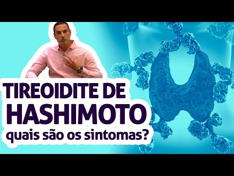 Tireoidite de Hashimoto: quais são os sintomas da tireoidite de Hashimoto?