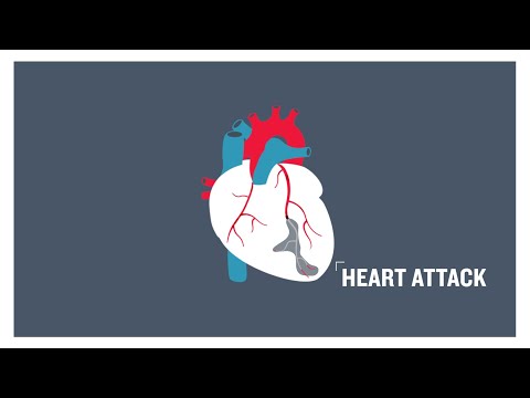 Heart attack, clogged arteries and atherosclerosis