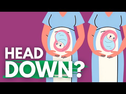 Is Your Baby Head Down? The Surprising Signs You Might Be Missing!