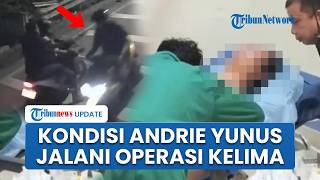 Andrie Yunus Selesai Jalani Operasi Kelima, Koordinator KontraS Ungkap Kondisi Terkini di RSCM