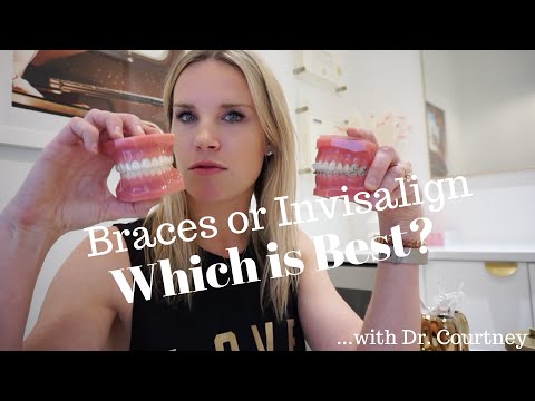 BRACES OR INVISALIGN CLEAR ALIGNERS? 2024 | Which is better?