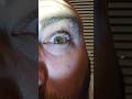 Green eyes