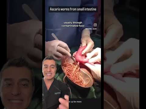Worms in INTESTINS?!