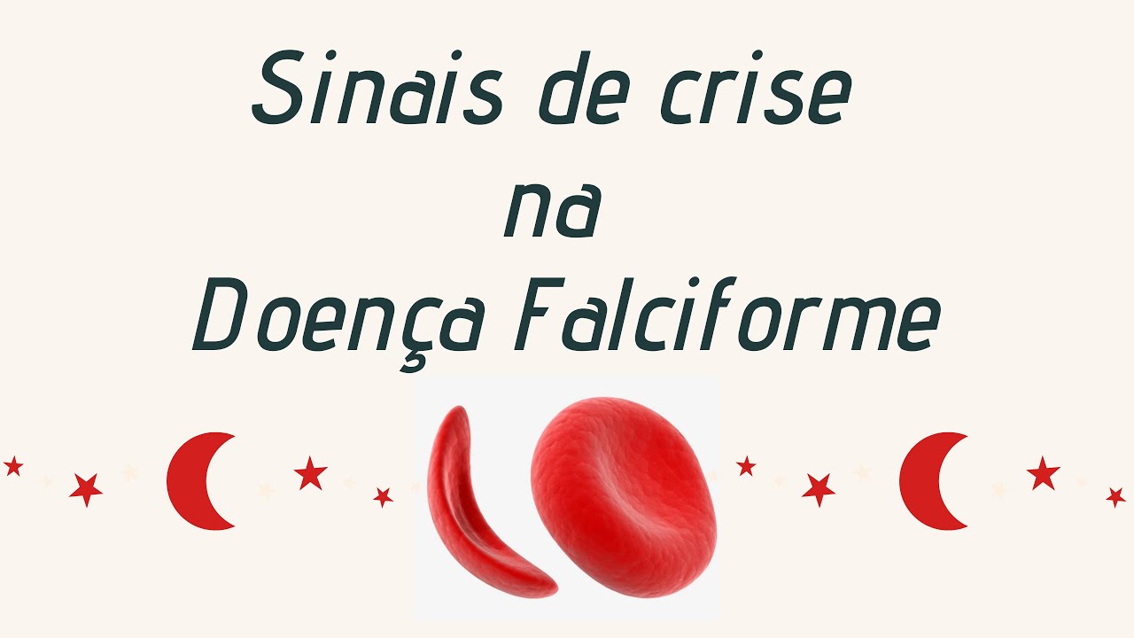 Crise de Dor na Doença Falciforme