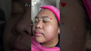Download lagu Treatment skinbooster terbaik, sekarang ada di nadifa!!! mp3