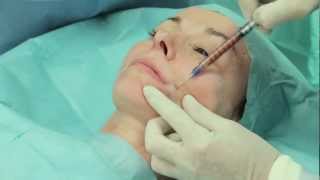 preview picture of video 'St'rim : Facial autologous fat micro grafting'