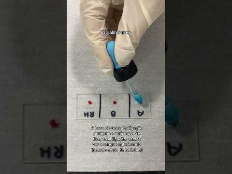 How the lab finds out your blood type #biomedicine #health #fyp