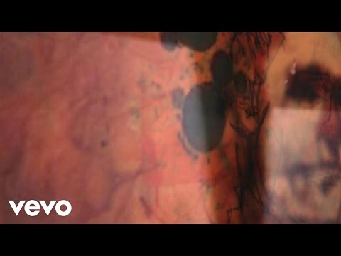 The Tragically Hip - Vaccination Scar (Official Video)