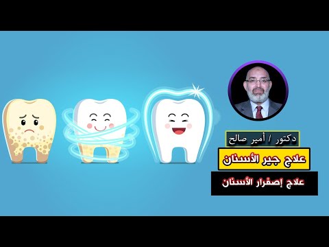 علاج جير الأسنان وصفارها برنامج الطب الأمن دكتور أمير صالح