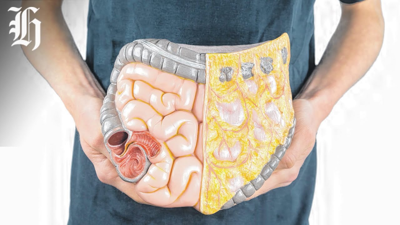 NZ's first dedicated support service for patients with gut cancers | Herald NOW