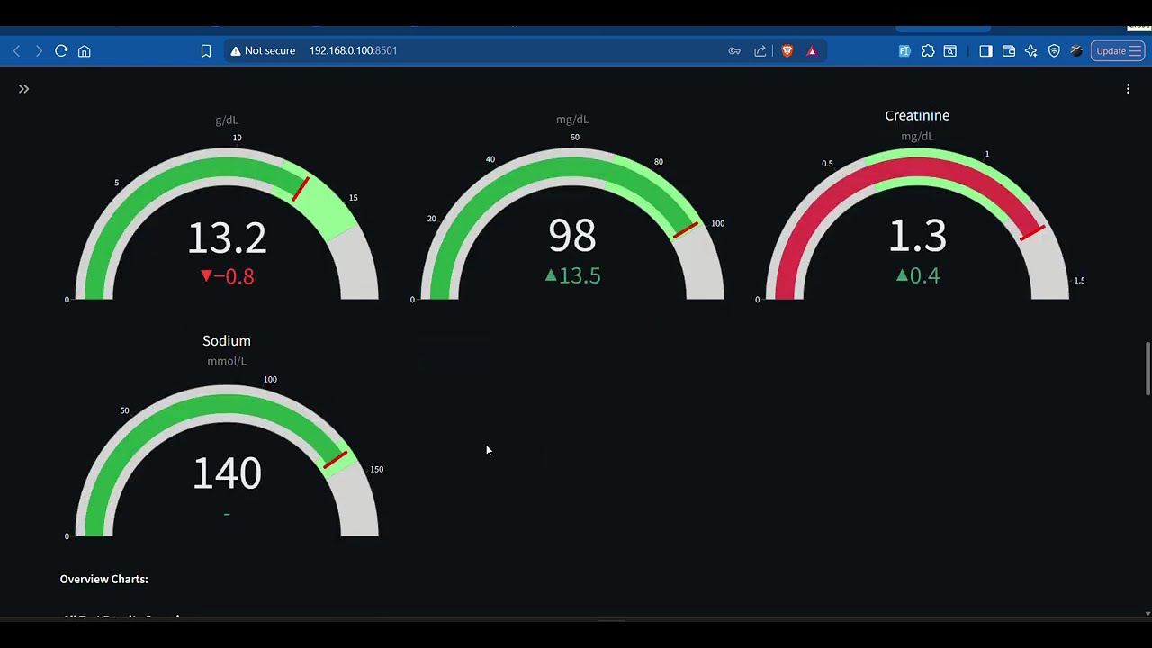 SehatScan AI – Making Lab Reports Simple, Safe, and Human | #MumbaiHacks 2025 (Healthtech Track)