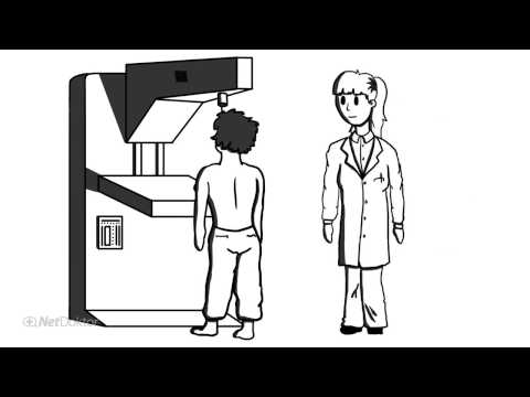 Was ist eine Mammografie? - NetDoktor.de