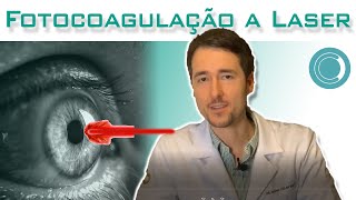 Fotocoagulação a laser para doenças da retina