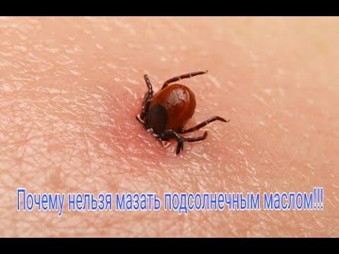 Как вытащить клеща! Как быстро вытащить клеща из тела человека|How to pull the tick!