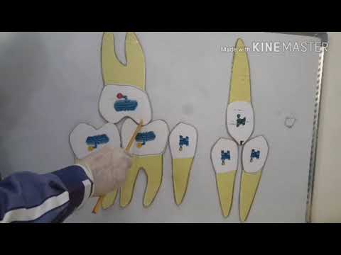 Molar class I ,angle classification in orthodontics