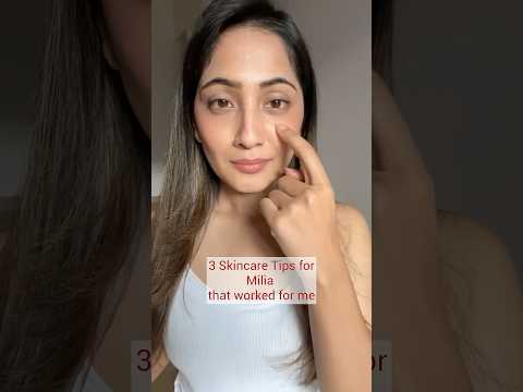 3 Easy Skincare Tips for Milia That Worked For Me