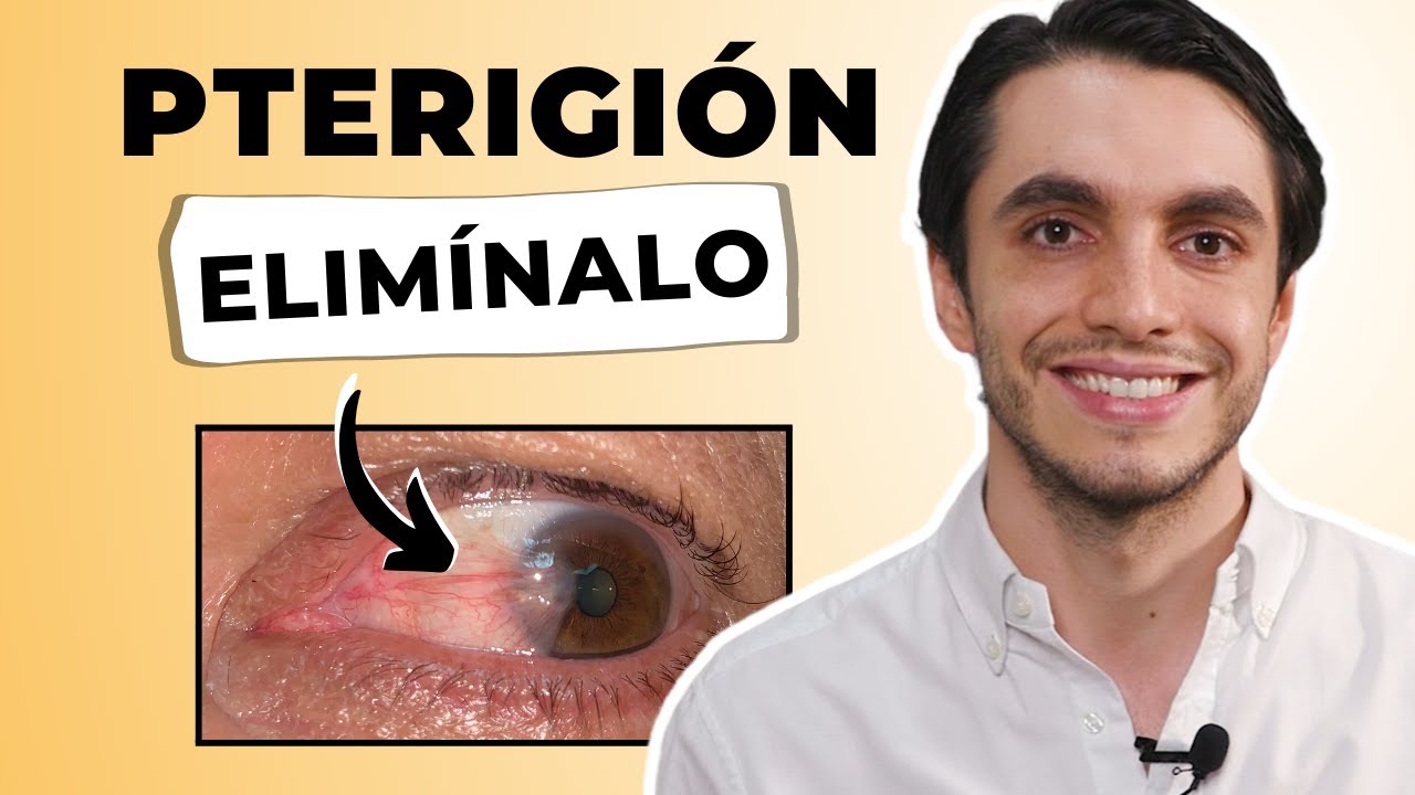✅ El MEJOR TRATAMIENTO para el PTERIGIÓN 💡¿Cómo ELIMINARLO con el Método PTR [ÚNICO]