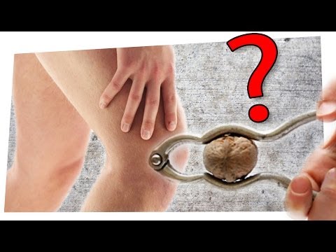 Unreifes Gelenk Myome und Schmerz