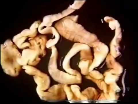 Herpes del papiloma humano